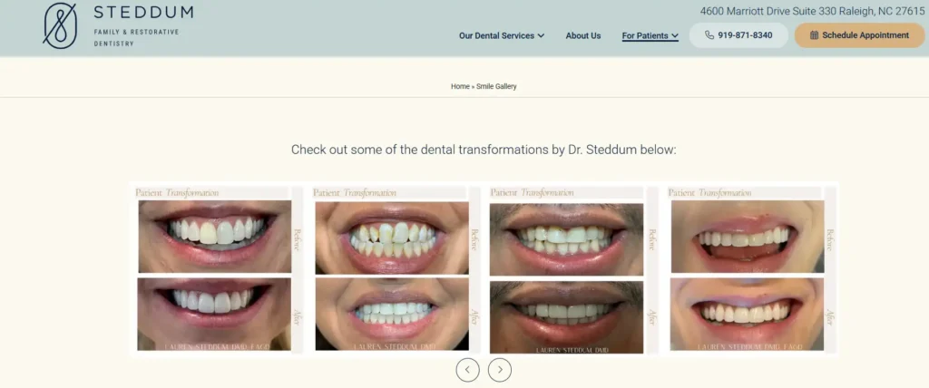 dental transformation gallery